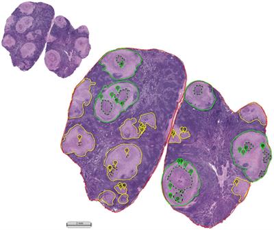 Histopathologic differences in granulomas of Mycobacterium bovis bacille Calmette Guérin (BCG) vaccinated and non-vaccinated cattle with bovine tuberculosis